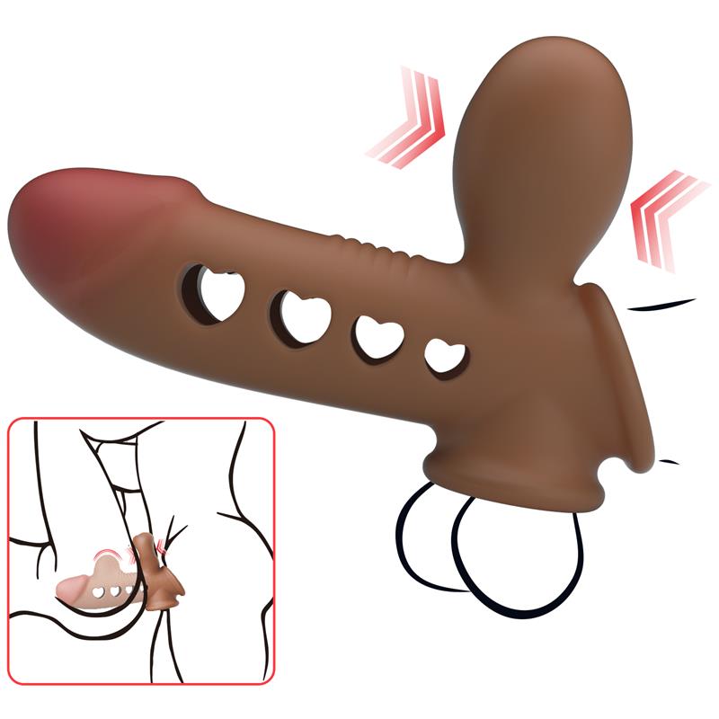 TYROON CARNE
